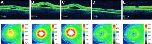 Figure 2 OCT studies and macular thickness of patient 7.