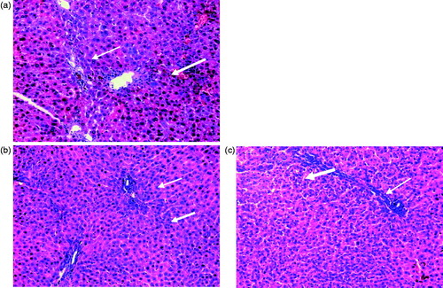 Figure 3. (a) Rats liver section injected with a single intraperitoneal dose (100 mg/kg) of TAA once per week for 1 month showing portal tract infiltration with chronic inflammatory cells (thin arrow), focal spotty necrosis (inflammatory cells in between hepatocytes, thick arrow, (b and c) rats injected with a single intraperitoneal dose (200 mg/kg or 300 mg/kg, respectively) of TAA once per week for 1 month showed portal tracts area infiltrated by moderate number of chronic inflammatory cells (thin arrow), focal spotty necrosis (thick arrow), inflammatory cells in between hepatocytes (H&E × 200).