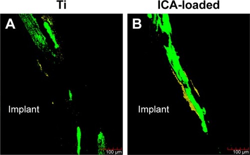 Figure 12 Fluorescence images of the rat femora after 2 weeks of implant placement in the Ti and ICA-loaded groups.Notes: Images of bone combined with TCH were stained yellow and those combined with CA was stained green. The yellow (TCH) and green (CA) staining in the images indicates the bone formation and mineralization rates at 1 and 2 weeks after the operation, respectively.Abbreviations: CA, calcein; ICA, icariin; TCH, tetracycline hydrochloride; Ti, titanium.