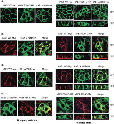 Figure 5.  (A) Immunofluorescence staining of kAE1 WT-HA557, kAE1 G701D-HA557 and kAE1 A858D-HA557, and (B) co-immunofluorescence staining of kAE1 WT-Myc557 and kAE1 G701D-HA557, (C) kAE1 WT-Myc557 and kAE1 A858D-HA557, and (D) kAE1 G701D-HA557 and kAE1 A858D-Myc557 in MDCK cells. MDCK cells were fixed, permeabilized and incubated with mouse anti-HA followed by anti-mouse IgG-Alexa488 antibodies (green) or rabbit anti-myc and mouse anti-HA followed by anti-rabbit IgG-cy3 (red). Yellow color indicated co-localization of the proteins. The images were observed by Zeiss LSM510 confocal microscope. Bar represents 10 μm. X–Y shows the top view of middle section and X–Z shows the side view of the polarized cells. (This figure is reproduced in colour in Molecular Membrane Biology online.)