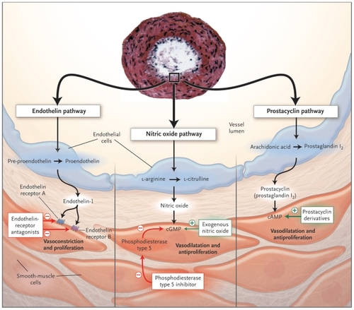 Figure 1 Cellular mechanisms of sildenafil actions.Reproduced with permission from Humbert M, Sitbon O, Simonneau G. Treatment of pulmonary arterial hypertension. N Engl J Med. 2004;351:1425–1436.Citation68 Copyright © 2004 Massachusetts Medical Society. All rights reserved.