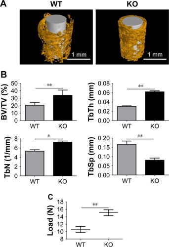 Figure 8 The effects of M1 polarization blocking on nanotopography-mediated osseointegration.Notes: The titanium implants with the NT-100 surface were inserted in the femurs of WT mice and Cre*RBP-Jfl/fl (KO) mice of which the M1 macrophage polarization was blocked. Then, WT mice and KO mice were allowed to heal for 3 weeks. (A) Micro-computed tomography analysis of osteogenesis around the implants in WT mice and KO mice. (B) The ratio of BV/TV, TbTh, TbN, and TbSp in the region of interest of WT mice and KO mice were analyzed. (C) Analysis of push-in resistance of implants in WT mice and KO mice. Means were compared with one-way analysis of variance combined with Bonferroni’s post-hoc test. *p<0.05; **p<0.01.Abbreviations: BV/TV, bone volume to total volume; KO, knockout; NT-30, titanium nanotube anodized under 5 V; NT-100, titanium nanotube anodized under 20 V; TbN, trabecular thickness; TbSp, trabecular separation; TbTh, trabecular thickness; WT, wild-type.