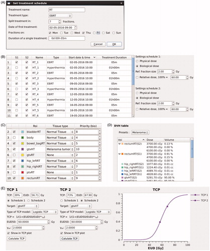Figure 2. Screen shots of several steps in the workflow. (A) Pop-up window to set the initial treatment schedule for an imported radiation dose or temperature distribution. (B) Treatment schedule tab, providing an overview of imported treatment fractions and settings for equivalent dose calculation. (C) ROI settings tab, where tissue types and priorities are assigned to each structure. (D) DVH parameter table, where a preset list of DVH parameters is selected and calculated. (E) TCP tab, where the target ROI, TCP model and TCP model parameters are selected. For a colour version of this figure, see the online version of this paper.