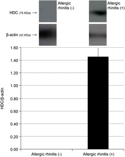 Figure 6. Histidine decarboxylase (HDC) protein expression in the human nasal mucosa of patients with/without allergic rhinitis, measured by western blotting.