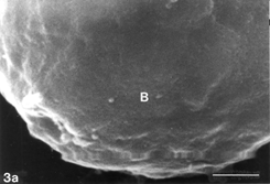 FIG. 3 10 mM AAP + 5 mM NAC, 24 h. Note apoptotic blebs (B) and absence of gaps on bleb's surface, the latter emerging from a flattened cell. Distended cell bodies harbors gaps (hollow arrows) about 1 µm in one dimension, an autoschizic appearance (A), filopodia tapered on (arrow) as well as detached from (curled arrow) the solid glass and barely developed microvilli. The many spaces among cells (3d) bear witness to intense cell shedding induced by AAP. Bar: (a) 1.0 µm; (b) 10 µm; (c) 100 µm;