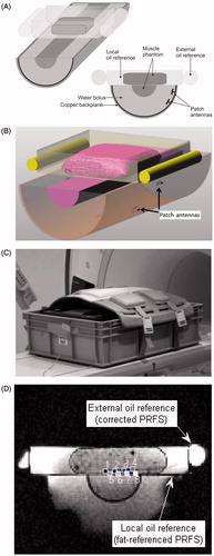 Figure 1. The H&N HT prototype MRT pilot set-up. (A) Schematic. (B) Simulation model. (C) Coil placement. (D) Coronal registration scan, indicating the external and local fat references and the top and bottom thermal probe sensors.