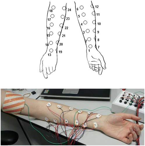 Figure 1. Anatomical placement of cathode and anode electrodes.Notes: Schematic showing placement of 24 cathode electrodes in four columns on the volar and dorsal surfaces of the left forearm. (Bottom) Photograph of placement of the 20-mm diameter (~3.14 cm2) cathodal electrodes 1–12 (Columns 1 and 2) on the volar surface of the left forearm. The large 51 × 102 mm (~52 cm2) rectangular anodal electrode can be seen between the body of the left biceps and triceps, as can the ShefStim breakout box (top right of photograph). During actual stimulation a cohesive bandage was wrapped around the forearm to secure the cathode electrodes in position.