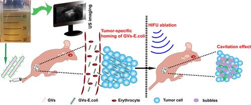 Figure 1 Schematic illustration of the GVs-E. coli for breast cancer therapy combing HIFU therapy and bacteriotherapy.