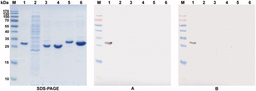 Figure 2. The reactivity of the MAbs 1D8 and 3C8 with denaturated recombinant CA I, CA II, CA VII, CA XII and CA XIII proteins. Left panel – SDS-PAGE; right panel – immunoblot with the MAbs 1D8 (A) and 3C8 (B). Line M, pre-stained MW markers (Thermo Fisher Scientific); line 1, purified recombinant CA XII protein expressed in E. coli; line 2, lysate of E. coli Rosetta (DE3) cells; line 3--6, purified recombinant CA I, CA II, CA VII and CA XIII proteins, respectively.