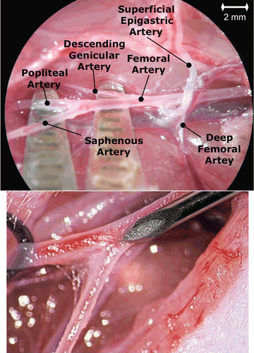 Figure 1.  Anatomy of the right hind leg in the rat depicting tumor inoculation and NP injection. A needle was inserted into the saphenous artery, which is branching off the superficial epigastric artery and MDA-MB-231 cells were injected (upper). By using suturing material (surgical thread) the tumor cells were directed to the descending genicular and popliteal arteries, which supply the knee joint and the muscles of the leg. Four weeks after tumor inoculation, NP were administered into the superficial epigastric artery (bottom).