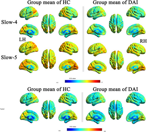 Figure 1 Whole-brain voxel-wise functional connectivity density (FCD) patterns in diffuse axonal injury patients and healthy controls.