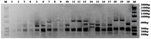 Figure 1a. ARDRA of 20 bacterial isolates with restriction endonuclease AluI.