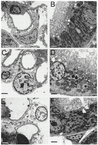 Figure 6. Transmission electron micrographs of glomeruli and proximal tubules. Kidneys were prepared for TEM, as described in MATERIALS AND METHODS. A and B are normal kidneys. C and D are kidneys after 90 min of warm ischemia. E and F are kidneys after 48 h of cold storage in UW solution. A, C and E show the glomerular filtration apparatus. B, D and F show proximal tubules. In C, note mild swelling of podocytes after warm ischemia compared to normal kidney (A). Podocyte changes were more marked after cold ischemia and included swelling of cells, pedicels and mitochondria, decreased cytoplasmic density, peripheral chromatin aggregation, and detachment of foot process from the basement membrane (E). In D, note marked swelling of microvilli and mitochondria, decreased cytoplasmic density, and partial loss of brush borders in proximal tubules after warm ischemia compared to normal kidney (B). Cold ischemia caused milder disruption of brush borders and thinning of tubular walls (F). Bars are 2 µm.