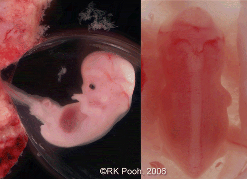 Figure 4.  Lateral and back view of aborted embryo at 8 weeks of gestation. (left) lateral view. Physiological umbilical hernia is seen. (right) backside view. Premature spinal cord is seen. This photo was taken just after abortion before preserving in formalin.
