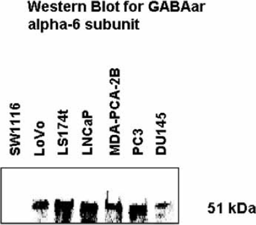 Figure 3.  Western blot of cell extracts from 4 human prostate cancer cell lines (LNCaP, MDA-PCA-2B, PC3 and DU145) and 3 human colon carcinoma cell lines (SW116, LoVo and LS174t), using anti-GABAa receptor (α-6 subunit) antibody.