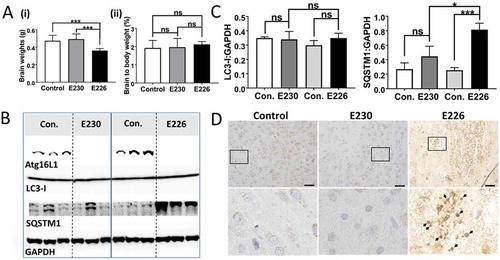 Figure 9. Analysis of brain. (A) Brain weights at 2–3 months expressed (i) directly: E230 (atg161E230 n = 8, control n = 7, E226 (atg16l1E226) n = 7, control = 7; or (ii) as percentage body weight: E230 (atg161E230 n = 8, control n = 9, E226 (atg16l1E226) n = 6, control = 5. (B) Western blot of brain lysates from 3 representative mice. Membrane strips taken from the appropriate molecular weight range were analyzed separately by western blot using the indicted antibodies. (C) Bar graphs show levels of LC3 and SQSTM1 relative to GAPDH. (D) Histochemical sections of brains were immunostained for SQSTM1. Enlarged regions of interest are shown in lower panels. Arrows indicate SQSTM1 inclusions. Data from control mice were pooled. Statistical analysis was done by unpaired t test. Error bars represents ±SEM. ***-P < 0.001, *-P < 0.1; ns, non-significant. Magnification 20X, scale bars: 50 µm.