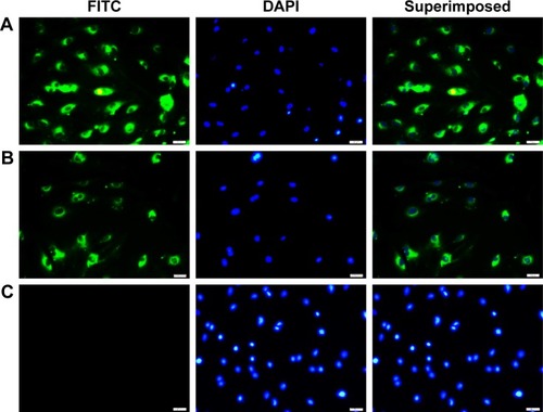 Figure 3 Uptake of coumarin-6 nanoparticles by stimulated VSMCs.Notes: (A) Shows the ENP group of cells. (B) Shows the NP group of cells. (C) Shows cells incubated with PBS only (0.01 M, pH 7.4). Nuclei are stained with DAPI (blue). Scale bar: 100 nm.Abbreviations: VSMCs, vascular smooth muscle cells; ENP, EGFP-EGF1-conjugated poly(lactic-co-glycolic acid) nanoparticle; NP, nanoparticle; FITC, fluorescein isothiocyanate.