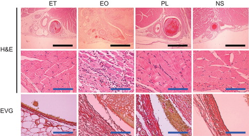 Figure 5. Representative histological findings of the femoral vein and the surrounding tissue 7 days after the injection of sclerotic agents. The black and blue scale bars represent 100 μm and 10 µm, respectively. H&E = haematoxylin and eosin; EVG = Elastica van Gieson.