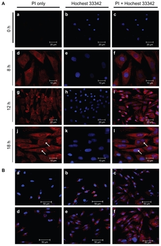 Figure 7 (A) Real-time imaging of CP-pDNA/propidium iodide (PI) nanoparticles after transfecting mesenchymal stem cells. First column, panels a, d, g and j show mesenchymal stem cells stained with propidium iodide only at 0, 8, 12, and 18 hours after transfection, respectively; second column, panels b, e, h and k show mesenchymal stem cells stained with Hoechst 33342 only at 0, 8, 12, and 18 hours after transfection, respectively; third column, panels c, f, i, and l show mesenchymal stem cells stained with both propidium iodide and Hoechst 33342 at 0, 8, 12, and 18 hours after transfection, respectively. (B) Confocal laser microscopy images of mesenchymal stem cells. Panels a, b, c show mesenchymal stem cells at 18 hours after transfection using needle-like calcium phosphate nanoparticles, standard calcium phosphate transfection, and Lipofectamine 2000, respectively; panels d, e, and f show mesenchymal stem cells at 4, 8, and 18 hours after transfection using CP-pDNA/propidium iodide nanoparticles.Abbreviations: CP, calcium phosphate; pDNA, plasmid DNA.