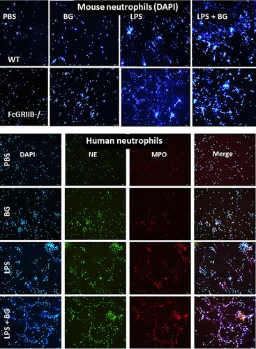 Figure 10 Representative immunofluorescent pictures for neutrophil extracellular traps (NETs) from wild-type (WT) or FcGRIIB-/- neutrophils after the 2 h activation by phosphate buffer solution (PBS) or (1→3)-β-D-glucan (BG) or lipopolysaccharide (LPS) or LPS with BG (LPS+BG) as determined by the branching of nucleus morphology using 4-,6-diamidino-2-phenylindole (DAPI), a nucleus stained color (blue), in mouse neutrophils (upper part) and the co-localization (merge purple color) of myeloperoxidase (MPO) (red) with neutrophil elastase (NE) (green) in human neutrophils (lower part) are demonstrated.