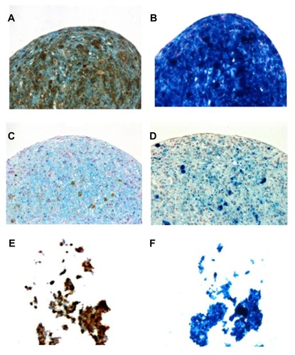 Figure 9 To determine whether hyaluronate molecules, which are also present in the cartilage extracellular matrix, can affect chondrogenic differentiation, rat bone marrow mesenchymal stem cells labeled with (A and B) dopamine-hyaluronate-maghemite nanoparticles Run IIIC/3, (C and D) Endorem® (Guerbet, Roissy, France), and (E and F) hyaluronate-maghemite nanoparticles Run II/3 were differentiated into a chondrogenic phenotype.Notes: The left column shows staining for Alcian Blue (a marker of chondrogenic differentiation), while the right column represents Prussian Blue staining. Iron is visible as (A, C and E) brown or (B, D and F) blue deposits.