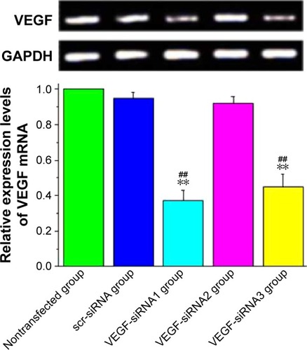 Figure 2 Quantitative determination of expression levels of VEGF mRNA in VX2 cells treated by three VEGF siRNAs and scr-siRNA at 48 hours by RT-qPCR assay.