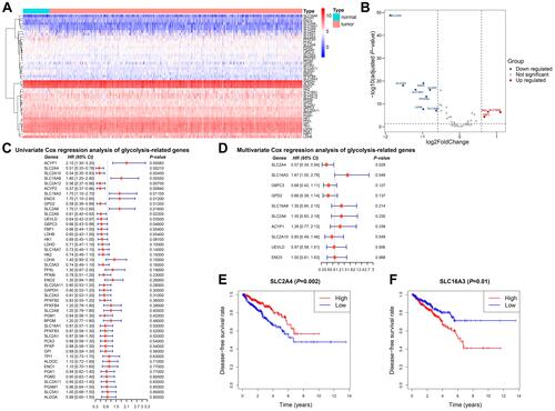 Figure 1 Expression and prognostic significance of glycolysis-related genes in prostate cancer. (A) Heatmap analysis of expression levels of 45 glycolysis-related genes. (B) Volcano plot for differentially expressed glycolysis-related genes. (C and D) Univariate and multivariate Cox regression of glycolysis-related genes. (E) Kaplan-Meier analysis of disease-free survival comparing low and high SLC2A4 expression. (F) Kaplan-Meier analysis of disease-free survival comparing low and high SLC16A3 expression.