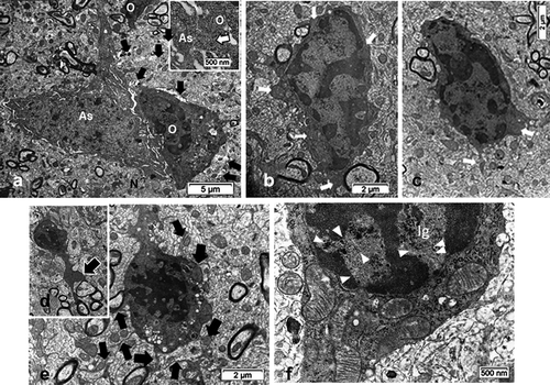 Figure 7. TEM aspects of ODS12h oligodendrocytes (O) from a demyelinating area of the mouse thalamus showing an enhanced cell contrast of both nucleus and cytoplasm. Displays of rare, scattered cisterns of endoplasm (in A-C) or clustered in the perikaryon and in parts of the extensions (also see in 7DF). The enlarged mitochondria profiles (white arrows in 7B) are reaching associated axons where myelin revealed adjacent neuropile blemishes, including discrete intercellular parenchymal spaces (black arrows in B and C). Associated with an astrocyte (As) in A, an insert of a small area (dotted square) is enlarged to illustrate the astrocyte-oligodendrocyte junctional membranes. B and C: Aspects of condensed heterochromatin where, among the contrasted, mottled nucleoplasm interchromatin more intensely contrasted granules appear. Note in all adjacent associated still myelinated axons