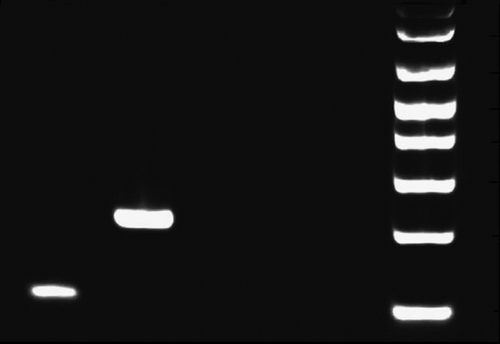 Figure 4.  Nested PCR demonstrating presence of MBR BCL2-IgH fusion. Lane 1: Patient sample; Lane 2: Positive MBR control; Lane 3: Polyclonal DNA; Lane 4: water; M-1kb ladder.