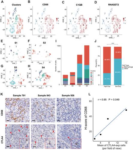 Figure 7 The expression of CTLA4 is related to the infiltration of macrophage. Relationship between CTLA4 and macrophage based on scRNA-seq data. (A) The tSNE algorithm was applied for dimensionality reduction and 10 cell clusters were successfully classified. (B–D) tSNE plots show the marker genes expression for macrophage. (E–H) tSNE plots show cell clusters of every single case. (I) Column plot shows cell number in every single case. (J) Difference in relative proportion of macrophage between high- and low-CTLA4 groups based on the mean value of CTLA4 expression. (K) Typical immunohistochemistry results of CTLA4-expressing cells and CD68-expressing macrophages (red arrows). Scale bars, 20 μm. Inset, high magnification. (L) Correlation of mean of CTLA4-expression cells per field of view and H-score of CD68 expression.***P < 0.001.