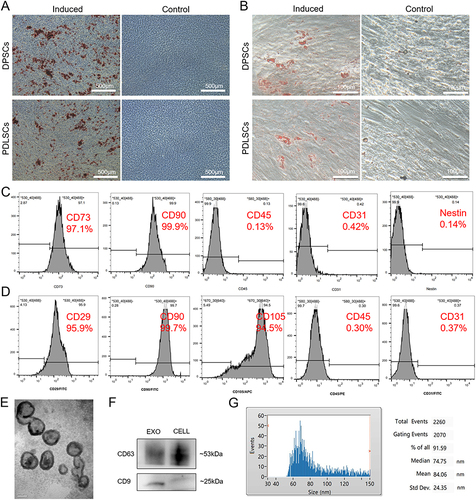 Figure 1 Identification of DPSCs, PDLSCs and DPSC-EXO. (A) Differentiation potential of osteogenesis of DPSCs and PDLSCs was confirmed by Alizarin red staining. (B) Differentiation potential of adipogenesis of DPSCs and PDLSCs was confirmed by Oil red O staining. (C) Identification of surface markers of DPSCs indicated that the harvested DPSCs were positive for CD73 and CD90 and were negative for CD45, CD31 and Nestin. (D) Identification of surface markers of PDLSCs indicated that the harvested PDLSCs were positive for CD29, CD90 and CD105 and negative for CD45 and CD31. (E) The typical saucer-like morphology of DPSC-EXO was captured by transmission electron microscopy. (F) DPSC-EXO was positive for the exosomal surface markers CD9 and CD63 by Western Blot. (G) Particle size of DPSC-EXO was analyzed by NTA.