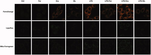 Figure 3. ISL inhibited Fe2+ and lipid peroxidation accumulation in LPS-stimulated cells. HK2 cells were treated with 50 μM or 100 μM ISL for 5 h, before septic AKI was induced using 2 μg/mL LPS. Cells were collected 24 h after LPS induction. FerroOrange was used as fluorescent probe to measure the level of Fe2+ in HK2 cells. Liperfluo was employed to detect the level of lipid peroxidation in HK2 cells. Mito-Ferrogreen could further detect Fe2+ ions in the mitochondria of HK2 cells. Magnification: ×60 oil.