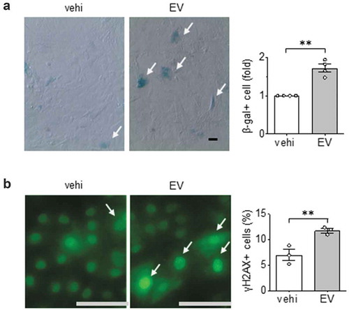 Figure 5. Pro-senescent effects of EC EVs on VSMCs. (a) Rat aortic VSMCs serum starved for 48 hours were incubated with EC EVs (109 particles) for 72 h and β galactosidase positive cells were counted (n = 3). (b) Rat aortic VSMC were serum-starved for 48 hours followed by incubation with EC EVs for 24 h followed by immunostaining with γH2Ax for DNA damage (n = 3). The bars in the graphs show the mean±SEM. ** indicates p < 0.01.