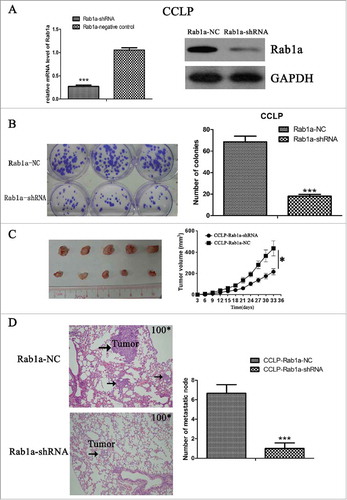 Figure 4. Suppression of Rab1a inhibits proliferation and migration of CCA cells in vivo (A) Both mRNA and protein levels were detected for verifying the transfect efficiency (B) Colony formation assay was conducted with Rab1a-shRNA and negative control cells (C) The effect of Rab1a suppression on tumorigenic capacity of CCLP cells was investigated in vivo through subcutaneously injection. The mice were sacrificed after 5 weeks, and subcutaneous tumors were shown. (D) The effect of Rab1a suppression on tumor migration of CCLP cells was investigated in vivo through tail vein injection. The mice were sacrificed after 40 ‘d’, and HE staining of mouse lung tissue containing metastasis was shown, the result was quantified and statistically analyzed.