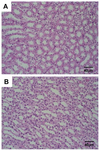 Figure 5 Photomicrographs of renal tissue from Ehrlich solid tumor-bearing Swiss mice treated by IV route with (A) SpHL and (B) SpHL-CDDP, at doses of 16 mg/kg, evaluated 23 days after treatment.Note: Hematoxylin and eosin staining.Abbreviations: IV, intravenous; SpHL, long-circulating and pH-sensitive liposomes; SpHL-CDDP, long-circulating and pH-sensitive liposomes containing CDDP (cisplatin).