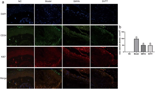 Figure 2. Effects of SMYA on vasa vasorum angiogenesis in aortic root plaques of as mice. (a) Immunofluorescence double staining was used to observe the density of vasa vasorum in aortic root plaques, CD34 was used as an endothelial cell marker, and Ki67 was used as a proliferating cell marker. The results showed that the positive staining density of CD34 and Ki67 in as plaques were significantly reduced after SMYA intervention (fluorescent microscopy, ×400). (b) after SMYA intervention, the density of vasa vasorum in the aortic root plaque was significantly reduced. Data are shown as mean ± SD. **p < 0.01, compared with the normal control (NC) group. ##p < 0.01, compared with the model group.