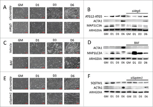 Figure 2. Blocking autophagy prevents myogenic differentiation. C2C12 cells were pretreated with autophagy-inhibiting agents and were subsequently differentiated. (A, C, and E) Phase contrast microscopy of differentiating C2C12s pretreated with either siRNA targeting Atg5 (A), BAF (C), or siRNA targeting Sqstm1 prior to differentiation (E). Scale bars: 100 µm. (B, D, and F) Western blot analysis of whole cell lysates from siAtg5 (B), BAF (D), or siSqstm1 (F)-treated cells. GM, growth medium.