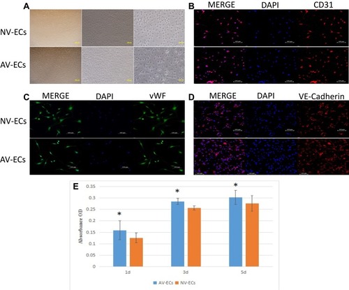 Figure 3 Proliferation of AV-ECs and NV-ECs. Morphology of AV-ECs and NV-ECs (A, magnification 4X, 10X, 20X). Immunostaining of CD31 (B), vWF (C) and VE-Cadherin (D) (magnification 20X). The nuclei were stained as blue by DAPI. MTT assay of the proliferation of AV-ECs and NV-ECs at 1d, 3d and 5d (E). Data are mean ± SD (n=3). *P<0.05 between AV-ECs and NV-ECs.