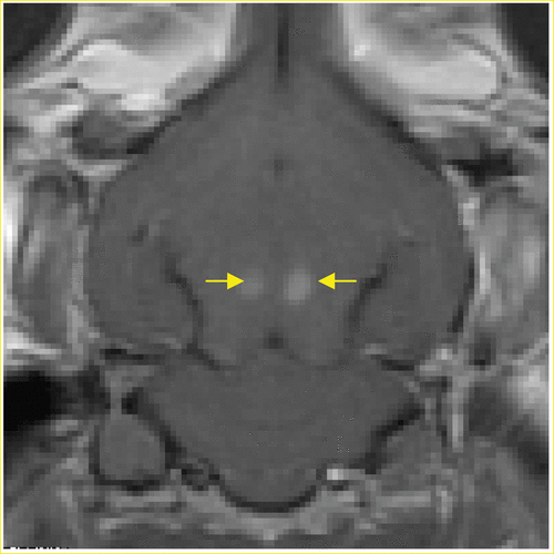 Figure 6. A T1-weighted contrast enhanced image of a rabbit brain showing two locations with disrupted blood–brain barrier Citation[80].