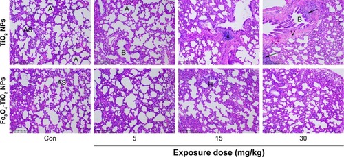 Figure 6 Photomicrography of lung histopathology.Notes: Images (magnification 10×) represent histopathological sections of the lung. Dark arrow in the 15 mg/kg TiO2 NP group represents edema and exudation around bronchi and a large amount of inflammatory cell infiltration. Dark arrows in the 30 mg/kg TiO2 NP group represent a large number of inflammatory infiltration around bronchi.Abbreviations: NP, nanoparticle; Con, control; A, alveolar space; B, bronchioles; H, histiocytes; AS, alveolar septa; V, veins.