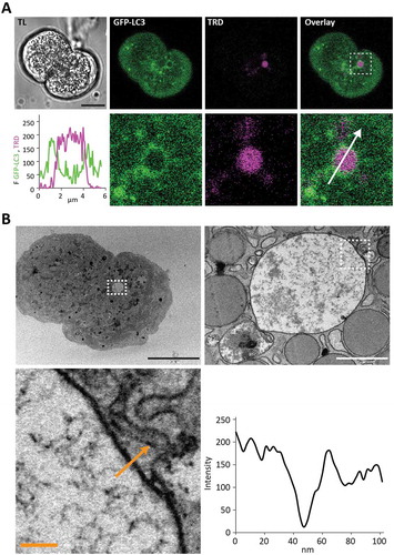 Figure 5. LC3-coated endocytic vacuoles have a single membrane. This figure shows correlation between live cell fluorescence images (A) and transmission electron microscopy (TEM) images (B) of the same cell containing a large LC3-coated endocytic vacuole. (A) Live cell images. TL indicates transmitted light image. Scale bar: 10 µm. GFP-LC3 (green) PACs were stimulated with 500 pM CCK in the presence of TRD (magenta). The endocytic vacuole (EV) selected for analysis is highlighted by a dashed box on the Overlay image (right panel in the top row). The region in the box is shown on the expanded scale in the low row of panels. The graph shows the intensity profile along the white arrow. (B) TEM images of the same cell and the same EV. Black scale bar corresponds to 10 µm, white scale bar corresponds to 1 µm, and yellow scale bar corresponds to 100 nm. The intensity profile along the yellow arrow is shown on the graph.