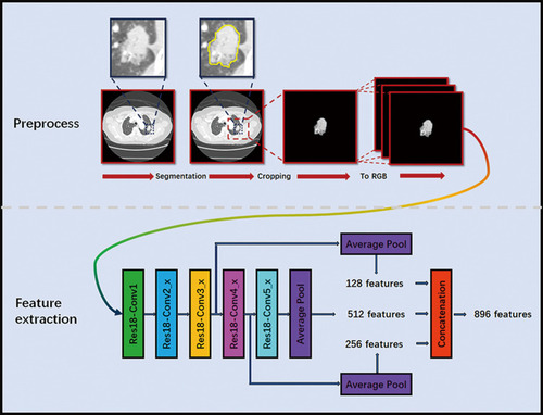 Figure 1 Deep learning workflow for feature extraction. Image segmentation was performed by experienced radiologist on the CT images. Sub-images contain whole tumor were cropping from the segmented images, and then combined into the RGB image. The deep learning features were extracted from the RGB images.