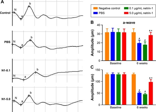 Figure 4 The electroretinography evaluation of the rats 6 weeks after intravitreal injection.