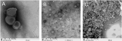Figure 2. TEM micrographs of the samples: (A) Original lipid vesicles; (B) ARM-NPs; (C) reconstructed liposomes.