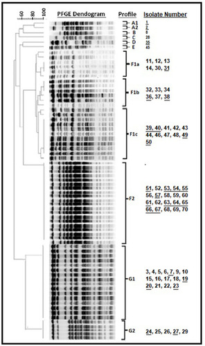 Figure 1 PFGE analysis of P. aeruginosa isolates generated seven major clusters (profile 1 (A1, A2, B, C, D, E), F1a, F1b, F1c, F2, G1 and G2). Community-associated samples were shown as underlined.