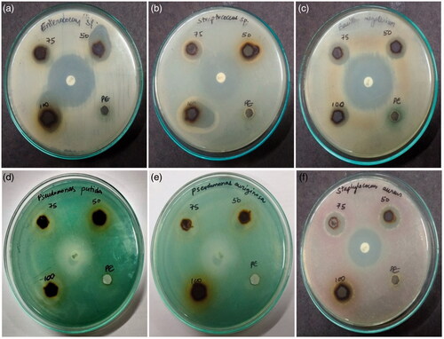 Figure 3. Antibacterial activity of Ag-NPs against human pathogens (a) Enterococcus sp., (b) Streptococcus sp, (c) Bacillus megaterium, (d) Pseudomonas putida (e) Pseudomonas aeruginosa, (f) Staphylocouus aureus. Concentration of Ag-NPs – 50, 75 and 100 µl; P.E- leaf extract.