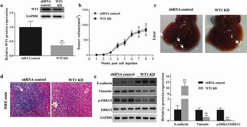 Figure 6. WT1 depletion reduces SKOV3 cells metastasis in vivo. (a) Western blotting was performed to confirm the knockdown efficiency of WT1 in established tumors. (b) Tumor growth curves were summarized in the line chart. (c) Image of metastatic liver nodules spreading throughout the live tissues in mice injected with shRNA control SKOV3 cells. WT1 knockdown clearly abolished the metastasis. White arrows indicated tumor foci. Bar = 1 mm. (d) Hematoxylin and eosin (H&E) staining was used to visualize the metastatic nodules in tumors from mice injected with shRNA control SKOV3 cells. The arrow indicated tumor foci. Magnification x 20. Bar = 50 μm. E, Western blot was performed to detect changes in the protein expression of EMT-associated genes proteins and ERK1/2 activation in the xenograft mouse primary tumors from the mice inoculated with WT1 KD cells compared to the controls. The lower panel of figure A or the panel on the right of figure E showed the quantification of the results. ** P < 0.01