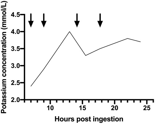 Figure 2. Potassium concentration during admission (reference range 3.5–5.2 mmol/L). Arrow indicates the administration of 20 mmol potassium chloride intravenously.