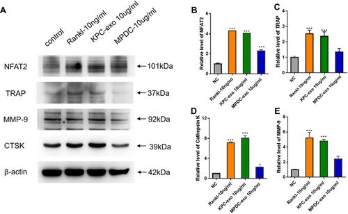 Figure 4 KPC-exosomes regulate osteoclastogenesis from RAW 264.7 cells. (A) The expression levels of NFAT2, TRAP, cathepsin K(CTSK) and MMP-9 were determined by Western blotting assay. (B–E) Relative NFAT2, TRAP, cathepsin K and MMP-9 mRNA levels were determined by qRT-PCR and normalized to GAPDH. *P < 0.05, *** P < 0.01 compared with control.