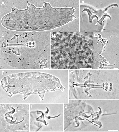 Figure 8. Ramazzottius subanomalus (A-E) and Ramazzottius thulini (F-J) (LM, PhC). A. Animal in toto. B. Claws of II leg, arrowhead = pseudolunule. C. Feeding apparatus. D. Egg surface. E. Claws of IV leg, arrowhead = pseudolunule. F. Animal in toto. G. Feeding apparatus. H. Claws of II leg. I. Claws of III leg. J. Claws of IV leg. A-C, E-J: holotype. Scale bars: A, F = 50 µm; B-E, G-J = 10 µm.